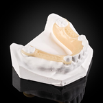 Hàm Khung Acetal