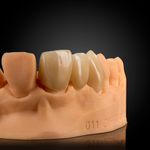 Phục Hình Cut-Back Zirconia