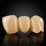 Phục Hình Cut-Back Zirconia