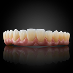 Phục Hình Thẩm Mỹ Toàn Hàm Trên Implant