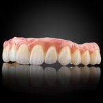 Phục Hình Thẩm Mỹ Toàn Hàm Trên Implant