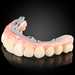 Phục Hình Toàn Hàm Trên Implant