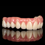 Full Arch Implant