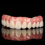Full Arch Implant
