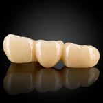 Phục Hình Zirconia Nguyên Khối