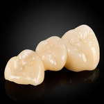 Phục Hình Zirconia Nguyên Khối