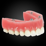 Phục Hình Tháo Lắp Trên Implant