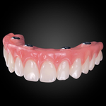 Phục Hình Tháo Lắp Trên Implant