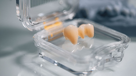 Sự Phát Triển Của Sứ Zirconia Trong Ứng Dụng Nha Khoa