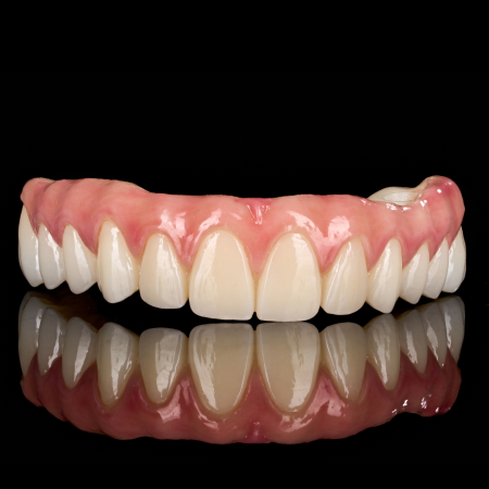 Full Arch Implant Full Arch Implant