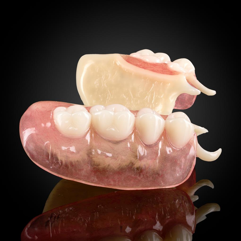 Phục Hình Tháo Lắp Bán Phần Khung Acetal