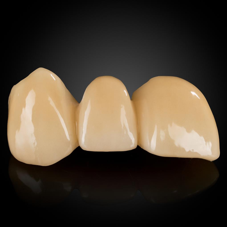 Phục Hình Cut-Back Zirconia