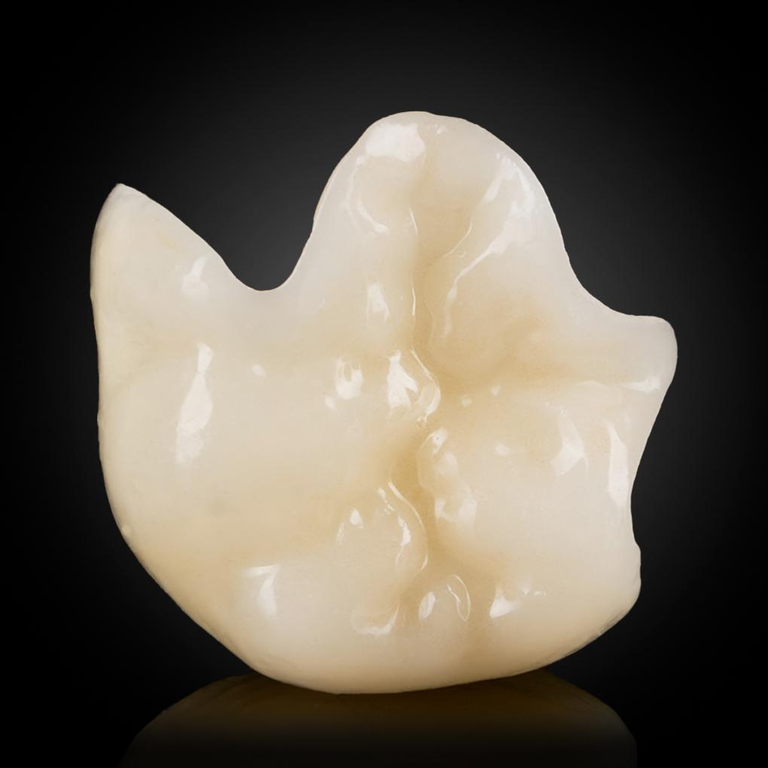 Phục Hình Mão Emax