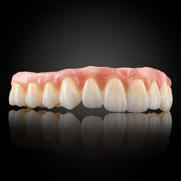 Phục Hình Thẩm Mỹ Toàn Hàm Trên Implant