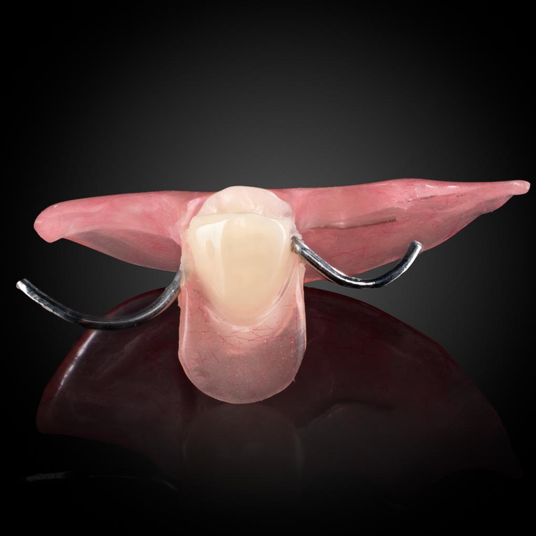Phục Hình Tháo Lắp Tạm - 1 Răng