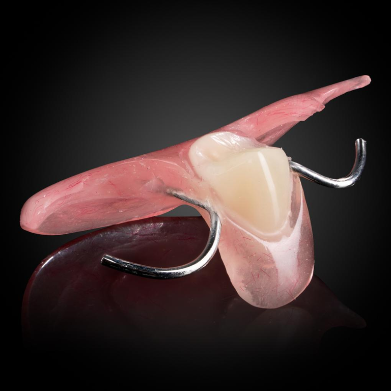 Phục Hình Tháo Lắp Tạm - 1 Răng