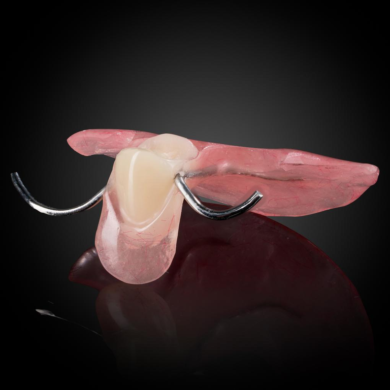 Phục Hình Tháo Lắp Tạm - 1 Răng
