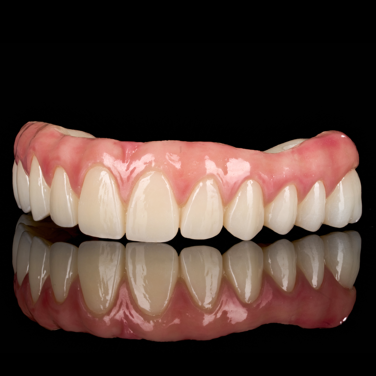 Full Arch Implant