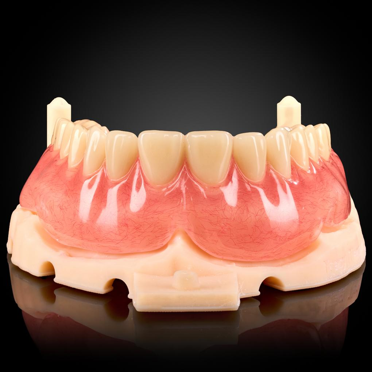 Phục Hình Tháo Lắp Toàn Hàm
