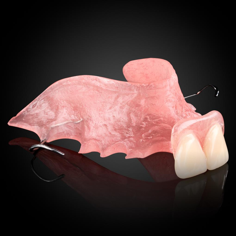 Phục Hình Tháo Lắp Tạm - Stay Plate