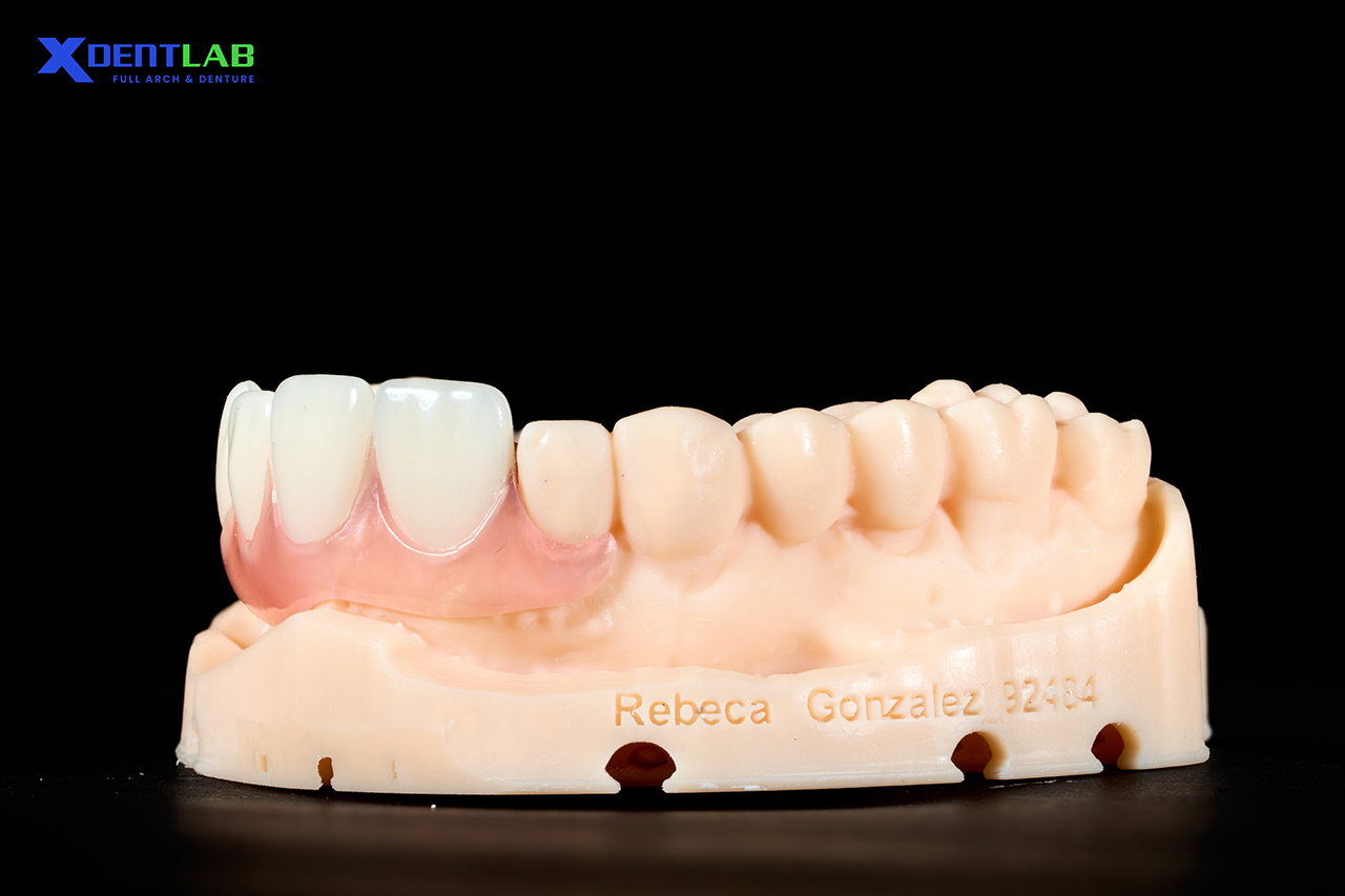Hàm Giả Tháo Lắp Bán Phần