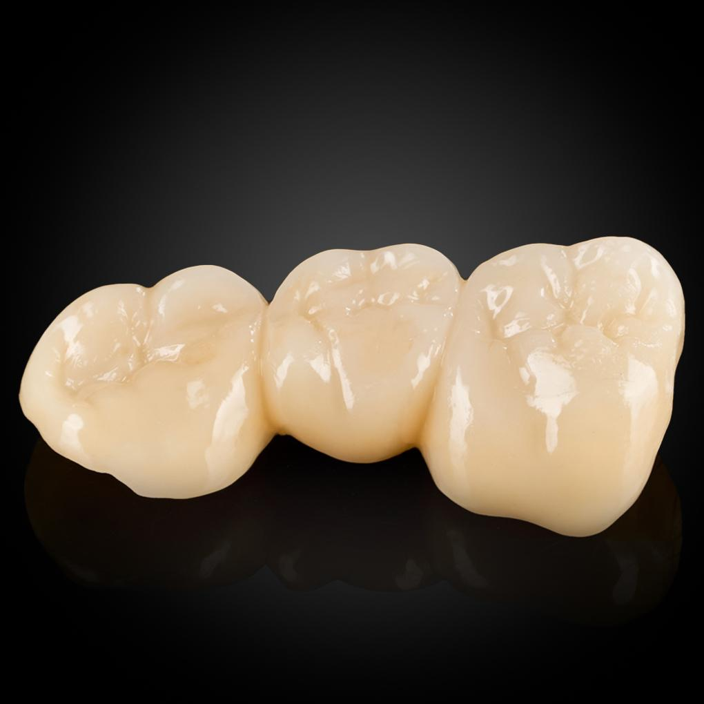 Răng Sứ & Cầu Răng Răng Sứ & Cầu Răng