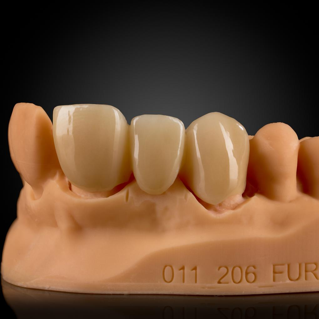 Phục Hình Zirconia