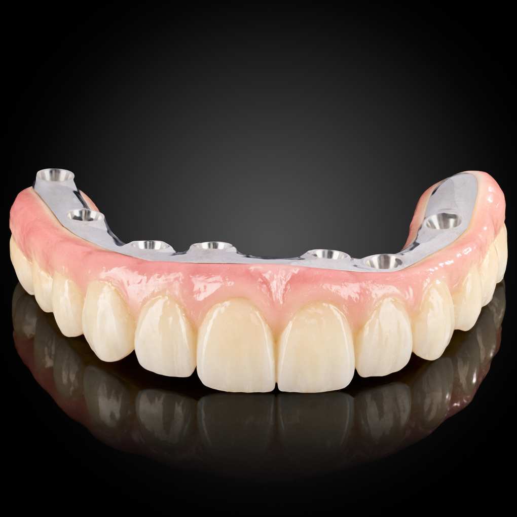 Phục Hình Toàn Hàm Trên Implant