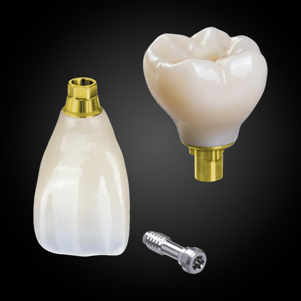 Phục Hình Bắt Vít Trên Implant