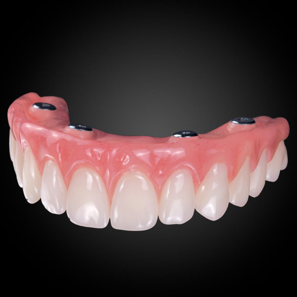 Phục Hình Tháo Lắp Trên Implant