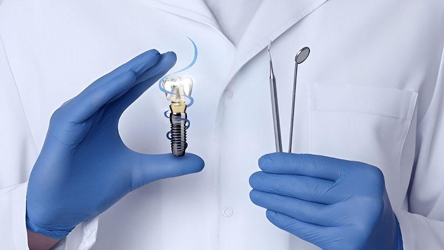 4 Dấu Hiệu và 7 Nguyên Nhân Thất Bại Khi Cấy Ghép Implant