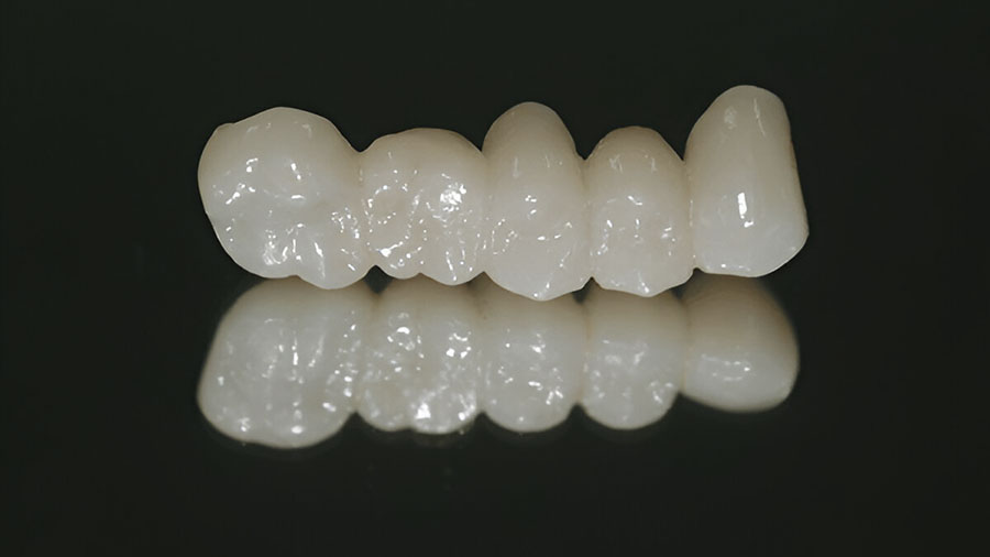 dental-lab-outsourcing-key-trends-for-2025