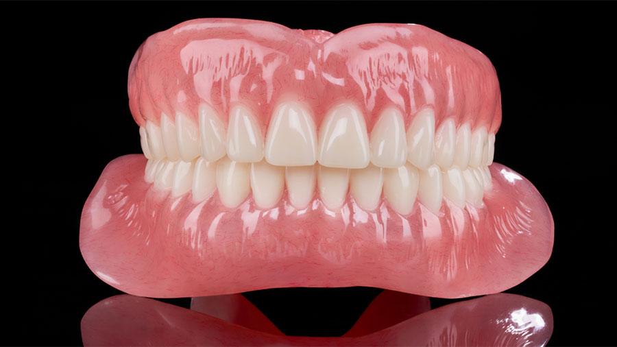 Định Hình Và Điều Chỉnh Sàn Miệng Đúng Cách Trong Chế Tác Hàm Giả Tháo Lắp