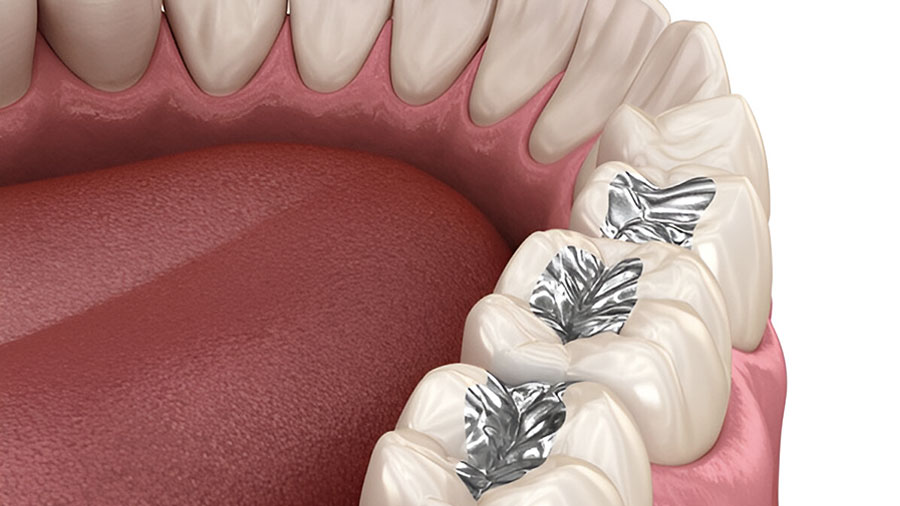 dental-lab-outsourcing-key-trends-for-2025