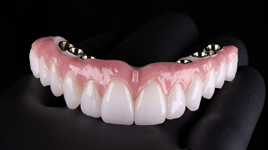 3Y-TZP Zirconia In Dental Ceramic Frameworks: A Comprehensive Overview