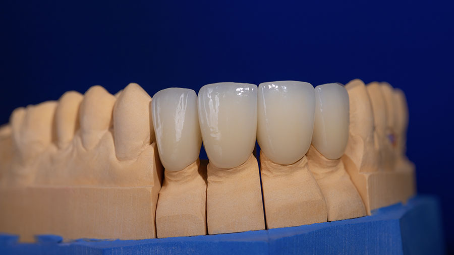 dental-lab-outsourcing-key-trends-for-2025