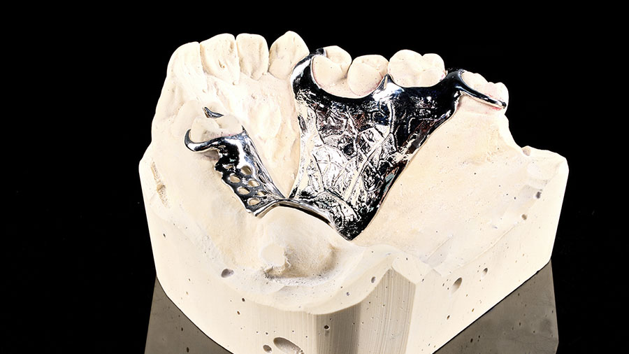 dental-lab-outsourcing-key-trends-for-2025
