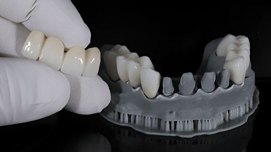 Overview Of 4Y-PSZ And 5Y-PSZ Zirconia In Dental Ceramics