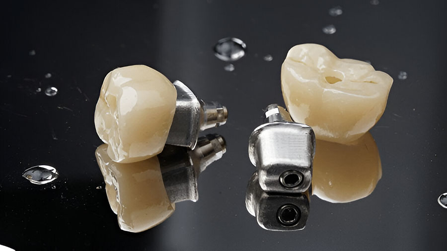 Why ZTA Is The Best Ceramic Material For Dental Crowns And Implants