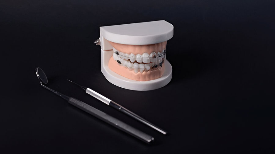 Orthodontic Materials: Innovations, Applications, And Future Trends